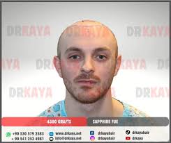 Sayın Andrew Clark Shepard'ın 12 aydaki sonucunu ve süreç boyunca  gelişimini sola kaydırarak görebilirsiniz.