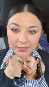 Testimonio Booster Niacinamida Mary Kay