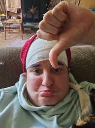 Don't know which is worse . Feeling off or dyskinesia! I seem to have one  or the other a lot of the time!