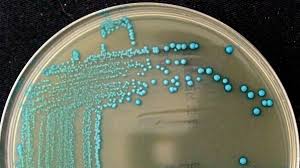 Even freezing doesn't stop it. All In The Family Cornell Adds Five Species To Listeria Genus Cornell Chronicle