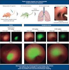 Image result for Primary Tumor Localization