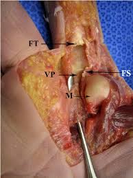 These cookies allow us to count visits, identify traffic sources, and understand how our services are being used so we can measure and improve performance. A Dislocated Index Mcp Joint With A Freer Is Under The Dtml Which Is Download Scientific Diagram