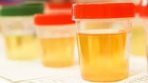 We did not find results for: Penyebab Urine Berwarna Kuning Setelah Minum Vitamin