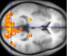 Maap services for autism, asperger syndrome, and pdd provides information, advice, and networking to families of more advanced. Asperger Syndrome Wikipedia