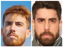 Let's welcome our 300 new members! **🤝 Also, check out * the **largest  pickleball Instagram** in the world:  [[https://bit.ly/TheKitchenIG](https://bit.ly/TheKitchenIG)](https://bit.ly/TheKitchenIG)  * the **best paddles/gear** check out Pickleball ...