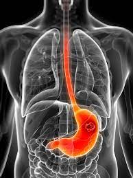 El dolor en el abdomen superior izquierdo debajo de las costillas puede tener una variedad de causas. Dolor En El Costado Izquierdo Sintoma De Algo Mas