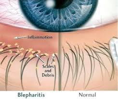Image result for Blepharis bainesii