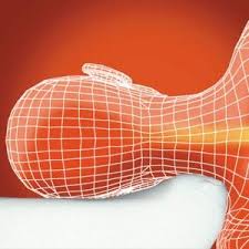 مخدة سويت دريم ميموري الطبية مخدة النوم الصحية مصممه هندسيا بحيث تاخذ شكل الجسم مع كل حركه لك اثناء النوم تعود تلقائيا لشكلها بعد الاست blog blog posts