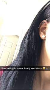 I Was About To Make A Visit To My Piercer Because The Swelling In My Ear Wasn T Going Down It S Been 2 Weeks Now And It S Finally Going Down It S Still Red Th