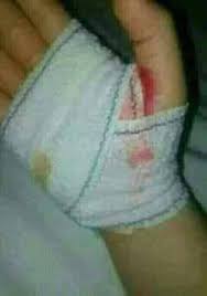 00 00 chi cha صور يد مجروحة facebook