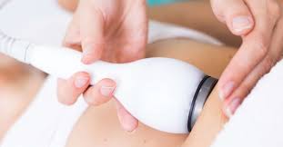 Coolsculpting Does It Work And Is It Safe