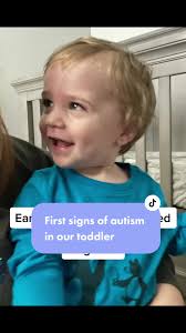 Biggest Signs of Autism 17 Months