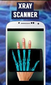 The app features over 300 high quality images, along with a range of case story images designed to enable readers to test and develop their interpretation skills. Xray Camera Scanner For Android Apk Download