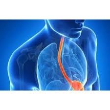 Check spelling or type a new query. Reflux Gastroesofagian Arsuri La Stomac DicÈ›ionar Medical