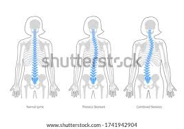 Anatomy of the backbone cervical spine. Shutterstock Puzzlepix