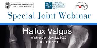 American orthopaedic foot & ankle society is a society of orthopaedic surgeons who treat injuries, diseases, and other conditions of the foot & ankle. Aofas On Twitter If You Missed Last Week S Webinar On Hallux Valgus Presented In Collaboration With Iffas And Cofas Watch The Recording As Cme Ondemand Https T Co 1nc1kriod9 Https T Co Htqprz6wov