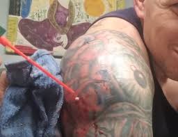 This is the truly revolting moment a river of brown pus erupts from a man's infected tattoo. Infected Tattoo Video On Facebook New Pimple Popping Videos