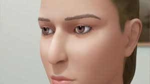 Graphic Shows The Full Procedure Of Nose Job Daily Mail Online