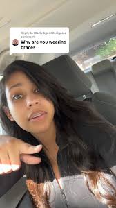 Where Did Jasmine Youtuber Get Her Teeth Done at