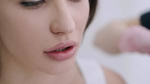 Filler für Lippen & Gesicht in Salzburg