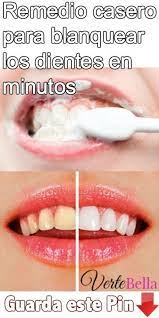 Remedio Para Blanquear Los Dientes En Minutos Blanquear Dientes Blanqueamiento De Dientes Blanqueador De Dientes