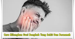 Caranya cukup mudah, ambil lemon yang sudah dibersihkan, lalu iris dan ambil airnya. Cara Hilangkan Gusi Bengkak Yang Sakit Dan Bernanah