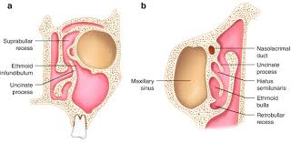 Image result for Maxillary Sinus
