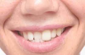 Por Que Se Mueven Los Dientes Bis Salud