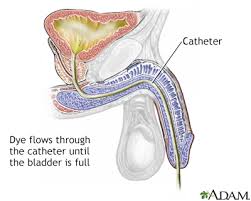 Image result for Voiding Cystourethrogram
