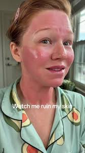 Penn Smith Skincare Microneedle