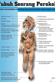 Sesetengah orang dapat berhenti merokok dengan mudah. Ini Dia Efek Samping Rokok Mulai Dari Ujung Rambut Sampai Ujung Kaki Www Detikriau Org