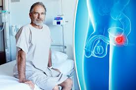 According to the prostate cancer foundation, difficulty getting an erection, as well as a decrease in the amount of fluid ejaculated and painful ejaculation, could be early signs of prostate. Prostate Cancer In Detail Morelia Medical Clinic