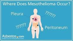 It has spread to distant organs, like the bones, the liver, the lung or pleura on the other side of the body, or the peritoneum (the lining of the abdomen) (m1). The Mesothelioma Center Youtube