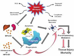 Using procalcitonin as a biomarker for severe infection may. Schematic Representation Of Pathophysiology Of Sepsis And I R Injury Download Scientific Diagram