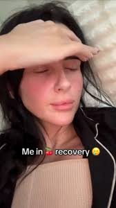 The glow up making it allll worth it 🥹 📸 Patient Repost!