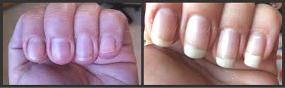 Ma come si possono ottenere delle unghie più forti e sane? Mya Beauty Review Nailtek Unghie Sane