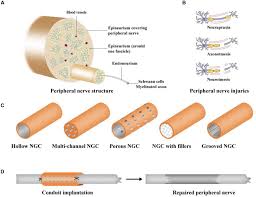 Frederick married ivy rosalie camile chong (born king shun) in 1917, at age 35 at marriage place. Frontiers Polymeric Guide Conduits For Peripheral Nerve Tissue Engineering Bioengineering And Biotechnology