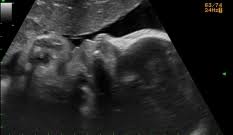 Maybe you would like to learn more about one of these? Semana 31 De Embarazo Inatal El Embarazo Semana A Semana