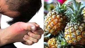 Cara Mengobati Asam Urat Terasa Sakit Dan Bengkak Coba Gunakan Ramuan Nanas Dan Madu Terbukti Tribun Manado