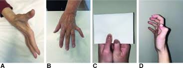 Image result for Hand Exam