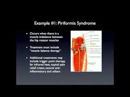 Pin On Piriformis Info And Exercises