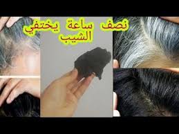 بدون قسم علاج الشيب نهائيا وللأبد في 1 ساعة واحدة تخلصي من الشيب نهائيا مثل السحر Youtube Unwanted Hair Removal Unwanted Hair Hair