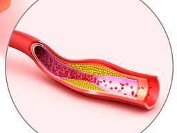 Some individuals may also experience hemorrhagic shock as a result of massive blood loss. Ruptured Spleen Symptoms Treatment And Causes