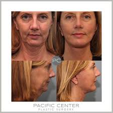 Pacific Center for Plastic Surgery, 3991 MacArthur Blvd, Ste 320, Newport  Beach, CA 92660, US