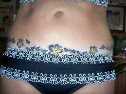 Tummy tuck tattoo pictures 05. Tattoo Over Tummy Tuck Scar Members Gallery Occ Forum Weight Loss Surgery