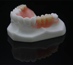 Beberapa macam gigi palsu seperti gigi palsu lepasan, cekat, dan gigi palsu yang diberi penyangga dental implant sehingga tinggalkan gigi palsu yang goyang dan tidak cekat saat dipakai makan. Pemasok Dan Produsen Gigi Tiruan Sebagian Valplast Pabrik Cina Wan Mei Dental Lab