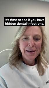 Trigeminal neuralgia is a severe facial pain disorder that can be caused by  hidden dental infections. Maybe a failed root canal or a improperly healed  extraction site. Treatment for trigeminal ...