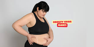 Image result for Obesity