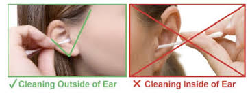 To complete the task, you'll want to let a few drops sit in your ear for a few minutes while tilting your head so that the ear faces the sky. Removing Earwax Kids Plus Pediatrics