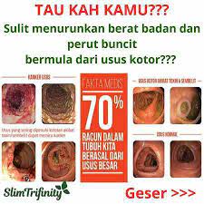 4 tanda usus anda kotor, dan bagaimana cara membersihkannya. Kenali Tanda Tanda Usus Kotor